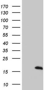 S100A9 Antibody in Western Blot (WB)