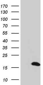 S100A9 Antibody in Western Blot (WB)