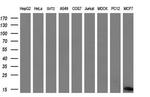 S100A9 Antibody in Western Blot (WB)