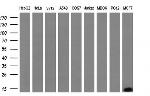 S100A9 Antibody in Western Blot (WB)