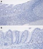 Calprotectin Antibody in Immunohistochemistry (Paraffin) (IHC (P))
