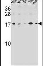 S100Z Antibody in Western Blot (WB)