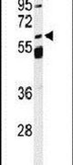 SLC13A5 Antibody in Western Blot (WB)