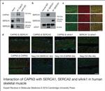 SERCA1 ATPase Antibody in Immunocytochemistry, Immunoprecipitation (ICC/IF, IP)