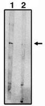 EDG8 Polyclonal Antibody