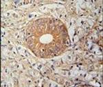 SLC35E2 Antibody in Immunohistochemistry (IHC)