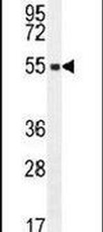 SLC35E2 Antibody in Western Blot (WB)