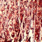 S6 Antibody in Immunohistochemistry (IHC)