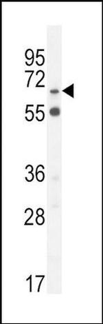 SLC6A12 Antibody in Western Blot (WB)