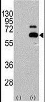 p70 S6 Kinase Antibody in Western Blot (WB)