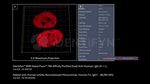 Human, IgG (H+L) SRM Secondary Antibody in Immunocytochemistry (ICC/IF)