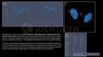 Rat, IgG (H+L) SRM Secondary Antibody in Immunocytochemistry (ICC/IF)