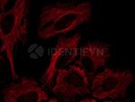 Rabbit IgG, (H+L) SRM Secondary Antibody in Immunocytochemistry (ICC/IF)