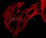 Human IgG, (H+L) SRM Secondary Antibody in Immunocytochemistry (ICC/IF)
