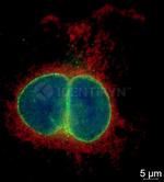 Mouse, IgG (H+L), (Subclasses 1+2a+2b+3), Fcy Fragment Specific SRM Secondary Antibody in Immunocytochemistry (ICC/IF)