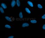 Mouse, IgG (H+L), (Subclasses 1+2a+2b+3), Fcy Fragment Specific SRM Secondary Antibody in Immunocytochemistry (ICC/IF)