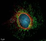 Rabbit IgG, (H+L) SRM Secondary Antibody in Immunocytochemistry (ICC/IF)