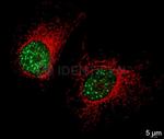 Human IgG, (H+L) SRM Secondary Antibody in Immunocytochemistry (ICC/IF)