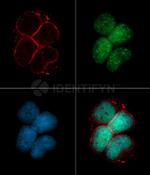 Human, IgG (H+L) SRM Secondary Antibody in Immunocytochemistry (ICC/IF)