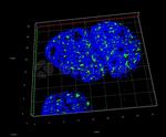 Human, IgG (H+L) SRM Secondary Antibody in Immunocytochemistry (ICC/IF)