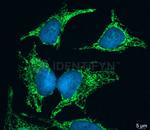 Mouse IgG, (H+L) SRM Secondary Antibody in Immunocytochemistry (ICC/IF)
