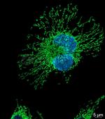 Mouse IgG, (H+L) SRM Secondary Antibody in Immunocytochemistry (ICC/IF)