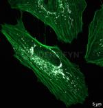 Rabbit IgG, (H+L) SRM Secondary Antibody in Immunocytochemistry (ICC/IF)