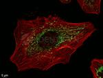 Mouse IgG, (H+L) SRM Secondary Antibody in Immunocytochemistry (ICC/IF)