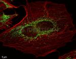 Mouse IgG, (H+L) SRM Secondary Antibody in Immunocytochemistry (ICC/IF)