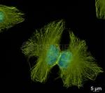Mouse, IgG (H+L), (Subclasses 1+2a+2b+3), Fcy Fragment Specific SRM Secondary Antibody in Immunocytochemistry (ICC/IF)