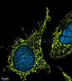 Mouse, IgG (H+L), (Subclasses 1+2a+2b+3), Fcy Fragment Specific SRM Secondary Antibody in Immunocytochemistry (ICC/IF)