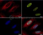 Human IgG, (H+L) SRM Secondary Antibody in Immunocytochemistry (ICC/IF)
