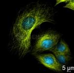 Mouse, IgG (H+L) SRM Secondary Antibody in Immunocytochemistry (ICC/IF)