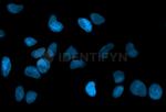 Mouse, IgG (H+L) SRM Secondary Antibody in Immunocytochemistry (ICC/IF)