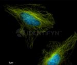 Mouse IgG, (H+L) SRM Secondary Antibody in Immunocytochemistry (ICC/IF)