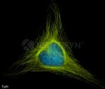 Rabbit IgG, (H+L) SRM Secondary Antibody in Immunocytochemistry (ICC/IF)