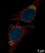 Rabbit IgG, (H+L) SRM Secondary Antibody in Immunocytochemistry (ICC/IF)