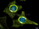 Mouse IgG, (H+L) SRM Secondary Antibody in Immunocytochemistry (ICC/IF)