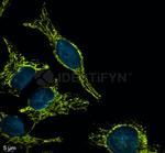 Mouse IgG, (H+L) SRM Secondary Antibody in Immunocytochemistry (ICC/IF)