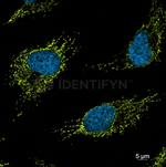 Mouse IgG, (H+L) SRM Secondary Antibody in Immunocytochemistry (ICC/IF)