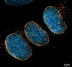 Mouse, IgG (H+L), (Subclasses 1+2a+2b+3), Fcy Fragment Specific SRM Secondary Antibody in Immunocytochemistry (ICC/IF)