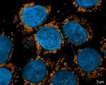 Rabbit IgG, (H+L) SRM Secondary Antibody in Immunocytochemistry (ICC/IF)