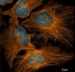 Mouse, IgG (H+L) SRM Secondary Antibody in Immunocytochemistry (ICC/IF)