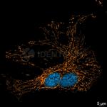 Mouse, IgG (H+L) SRM Secondary Antibody in Immunocytochemistry (ICC/IF)