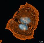 Rabbit IgG, (H+L) SRM Secondary Antibody in Immunocytochemistry (ICC/IF)