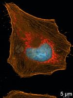 Rabbit IgG, (H+L) SRM Secondary Antibody in Immunocytochemistry (ICC/IF)