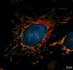 Mouse IgG, (H+L) SRM Secondary Antibody in Immunocytochemistry (ICC/IF)