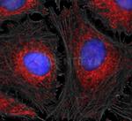 Mouse, IgG (H+L), (Subclasses 1+2a+2b+3), Fcy Fragment Specific SRM Secondary Antibody in Immunocytochemistry (ICC/IF)