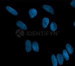 Mouse, IgG (H+L), (Subclasses 1+2a+2b+3), Fcy Fragment Specific SRM Secondary Antibody in Immunocytochemistry (ICC/IF)