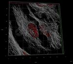Human IgG, (H+L) SRM Secondary Antibody in Immunocytochemistry (ICC/IF)